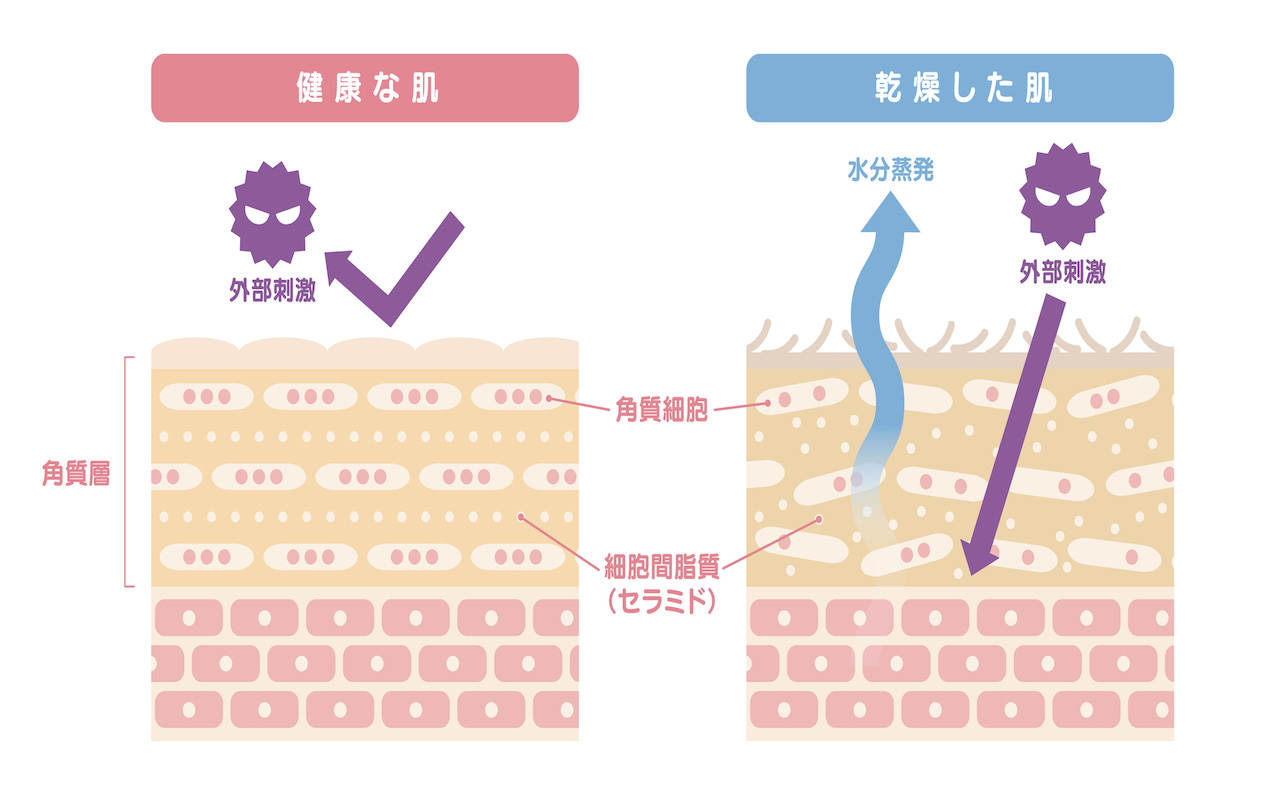 健康な肌　乾燥した肌